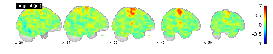 <Figure size 986.4x165.6 with 7 Axes>