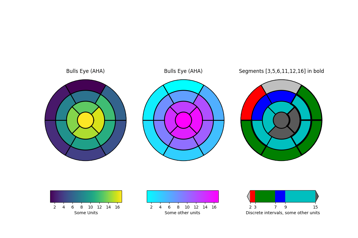 ../../_images/sphx_glr_leftventricle_bulleye_001.png