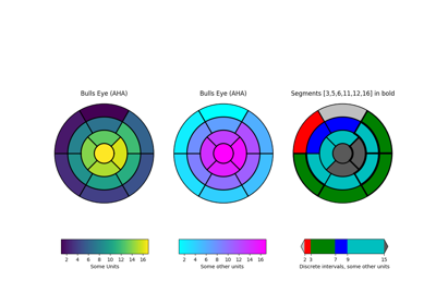 ../../_images/sphx_glr_leftventricle_bulleye_thumb.png