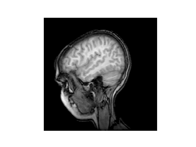 ../../_images/sphx_glr_mri_demo_001.png