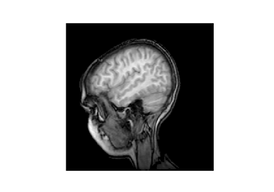 ../_images/sphx_glr_mri_demo_thumb.png