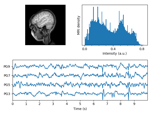 ../../_images/sphx_glr_mri_with_eeg_001.png